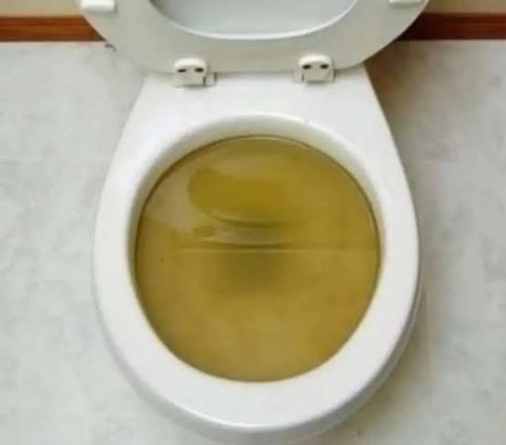 Jasa WC Mampet Bali